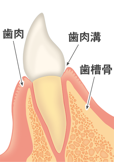歯周病とは？