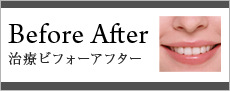 Bfore After　治療ビフォーアフター